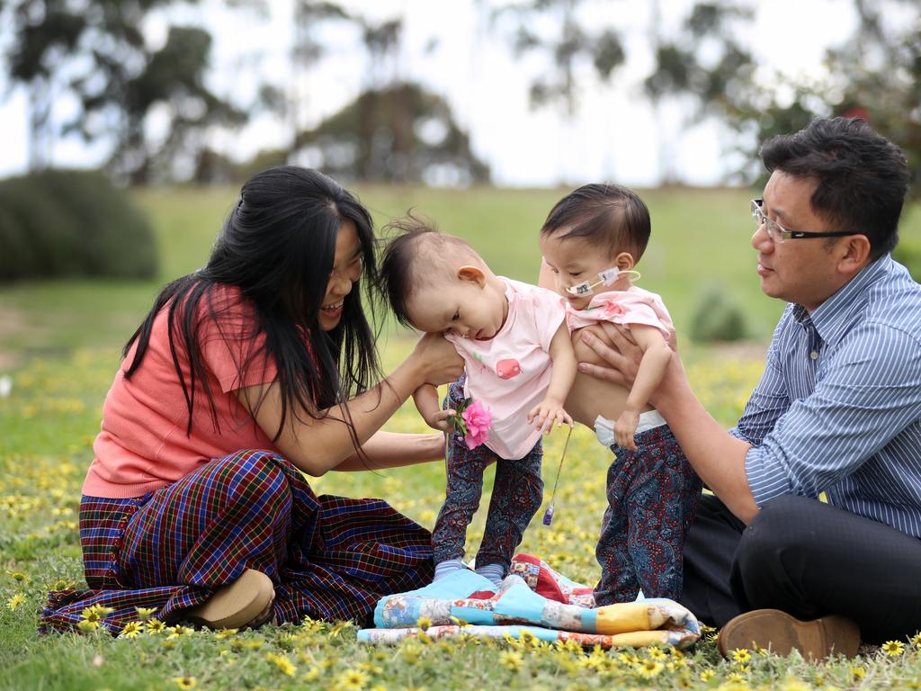 Mum Bhumchu with Nima and Dawa with visiting Bhutanese paediatric surgeon Dr Karma Sherbub. Picture: Alex Coppel