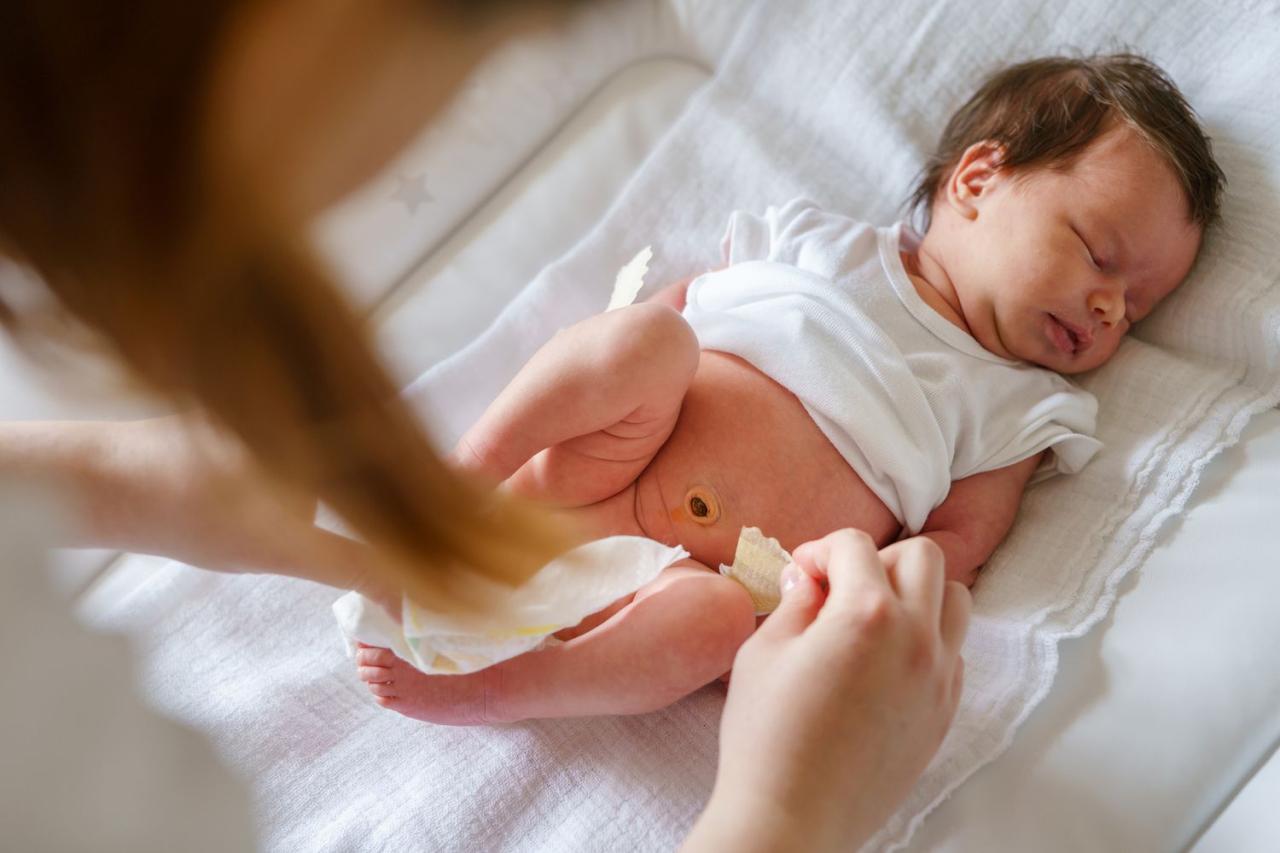 What To Do If Your Baby's Umbilical Cord is Bleeding