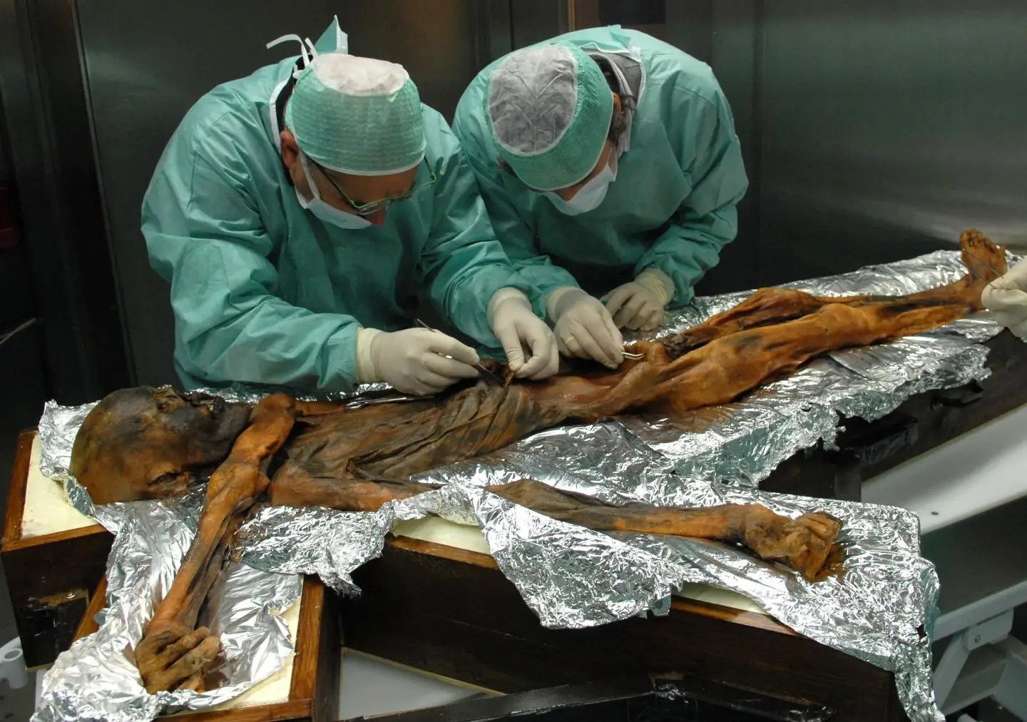 After 5,300 years, the last meal of an ancient Iceman has been revealed – and it was a high-fat, meaty feast