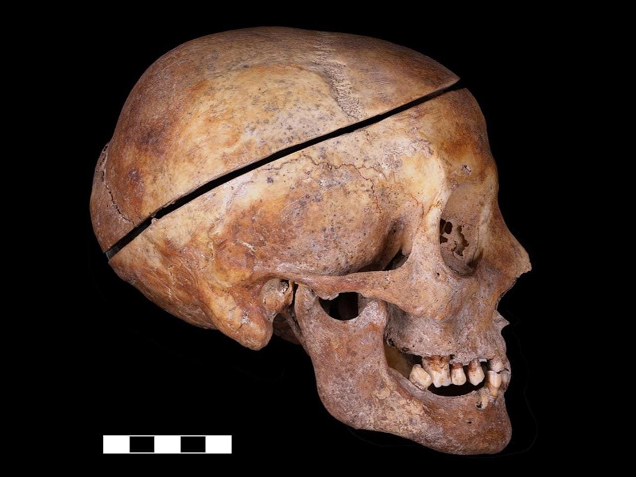 Archaeologists find first evidence of familial embalming in Europe