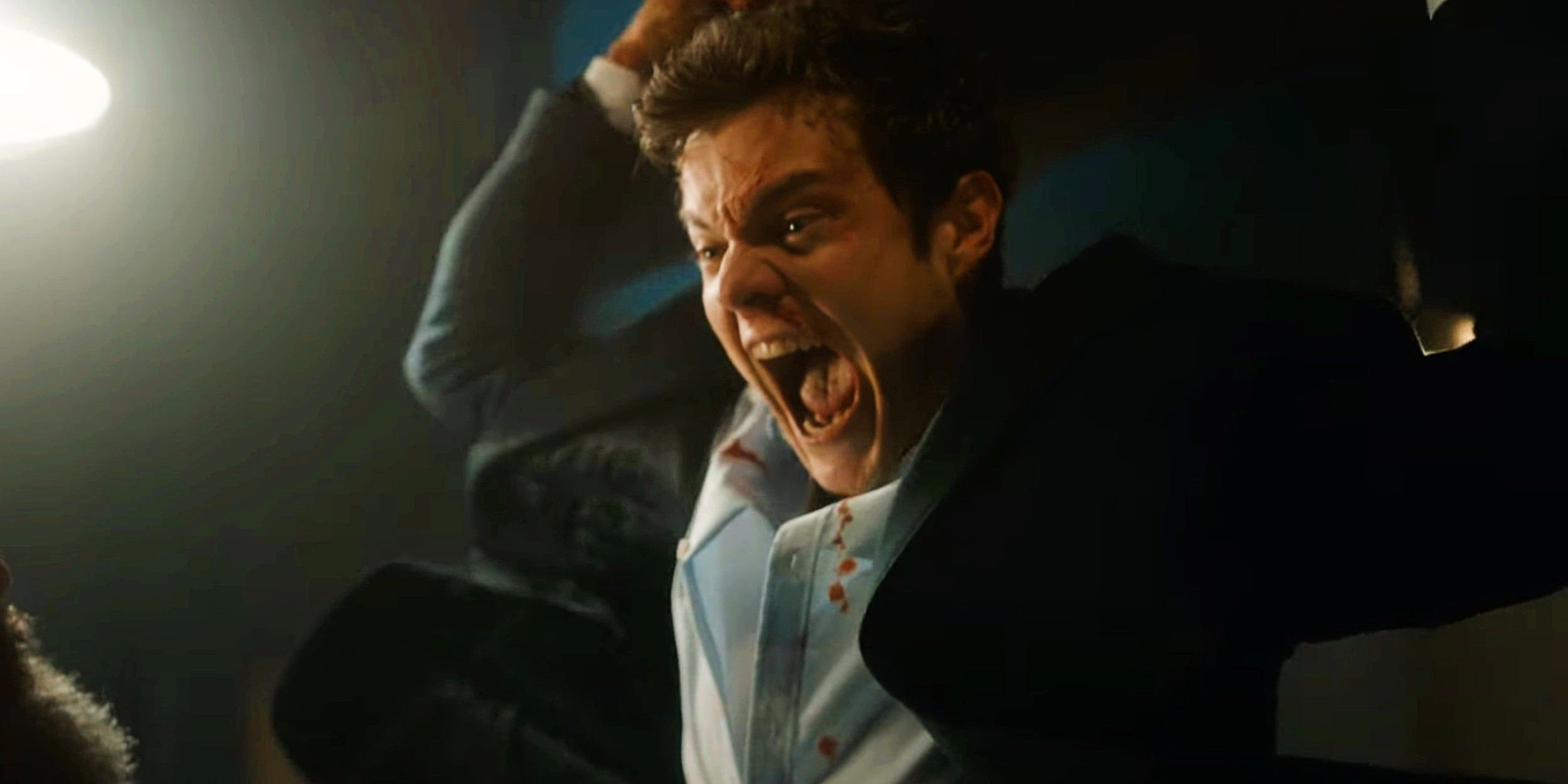 Novocaine Super Bowl Trailer: The Boys’ Jack Quaid Feels No Pain, So He Becomes The Action Hero With A Grin