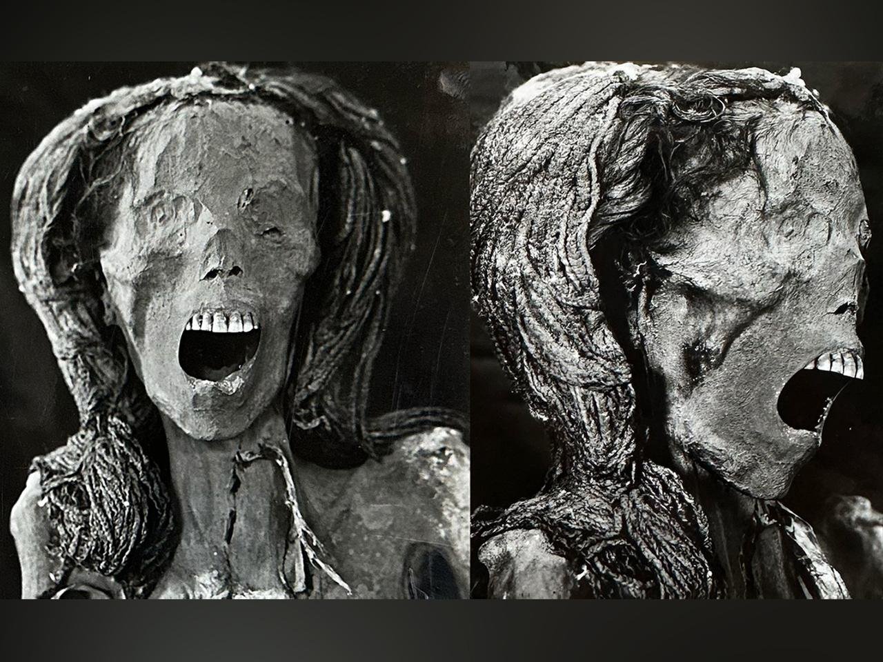 Mysterious “Screaming Woman” mummy suffered a painful death in ancient Egypt, study suggests