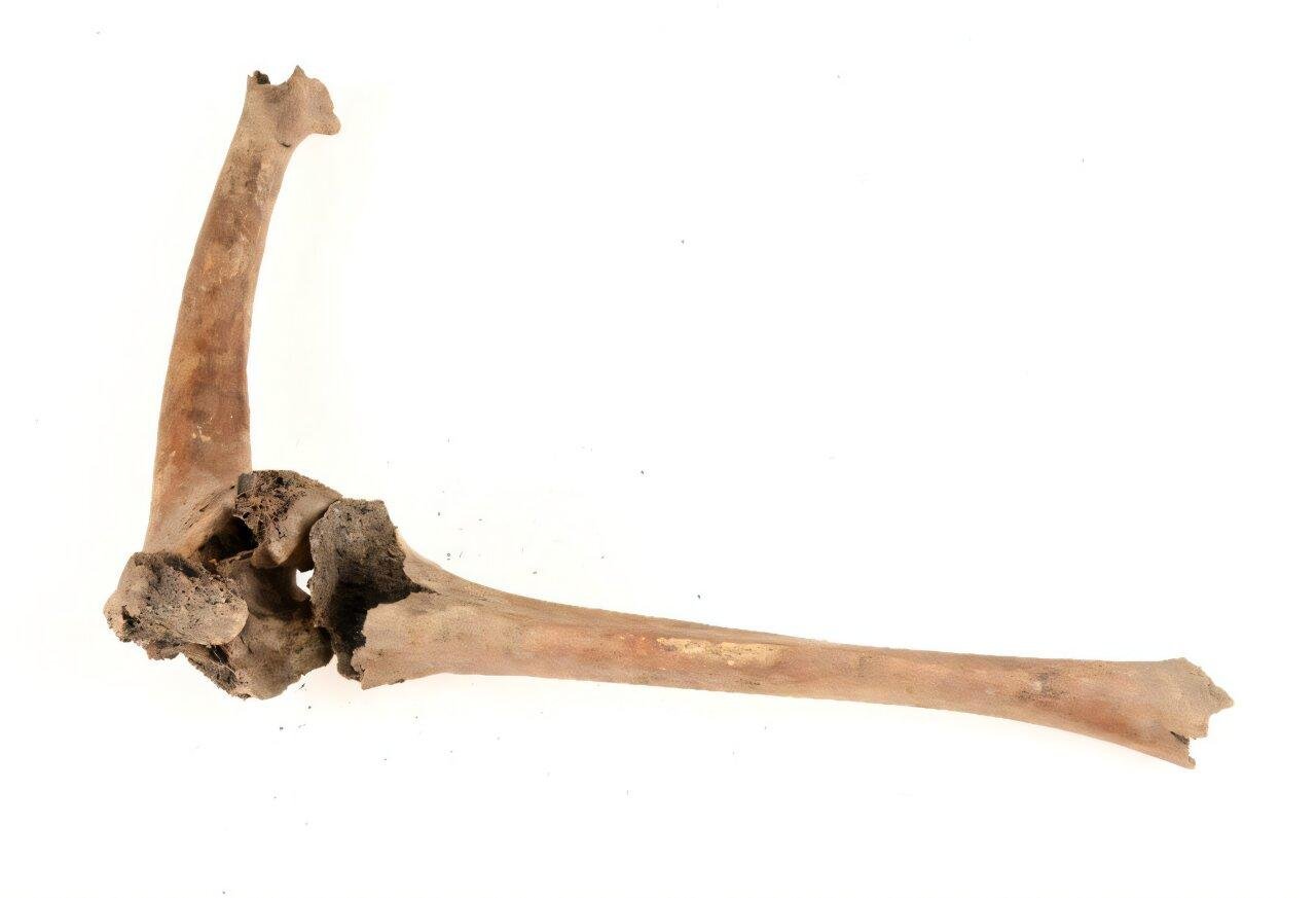 Medieval man with crippled knee reveals disability care in Sweden