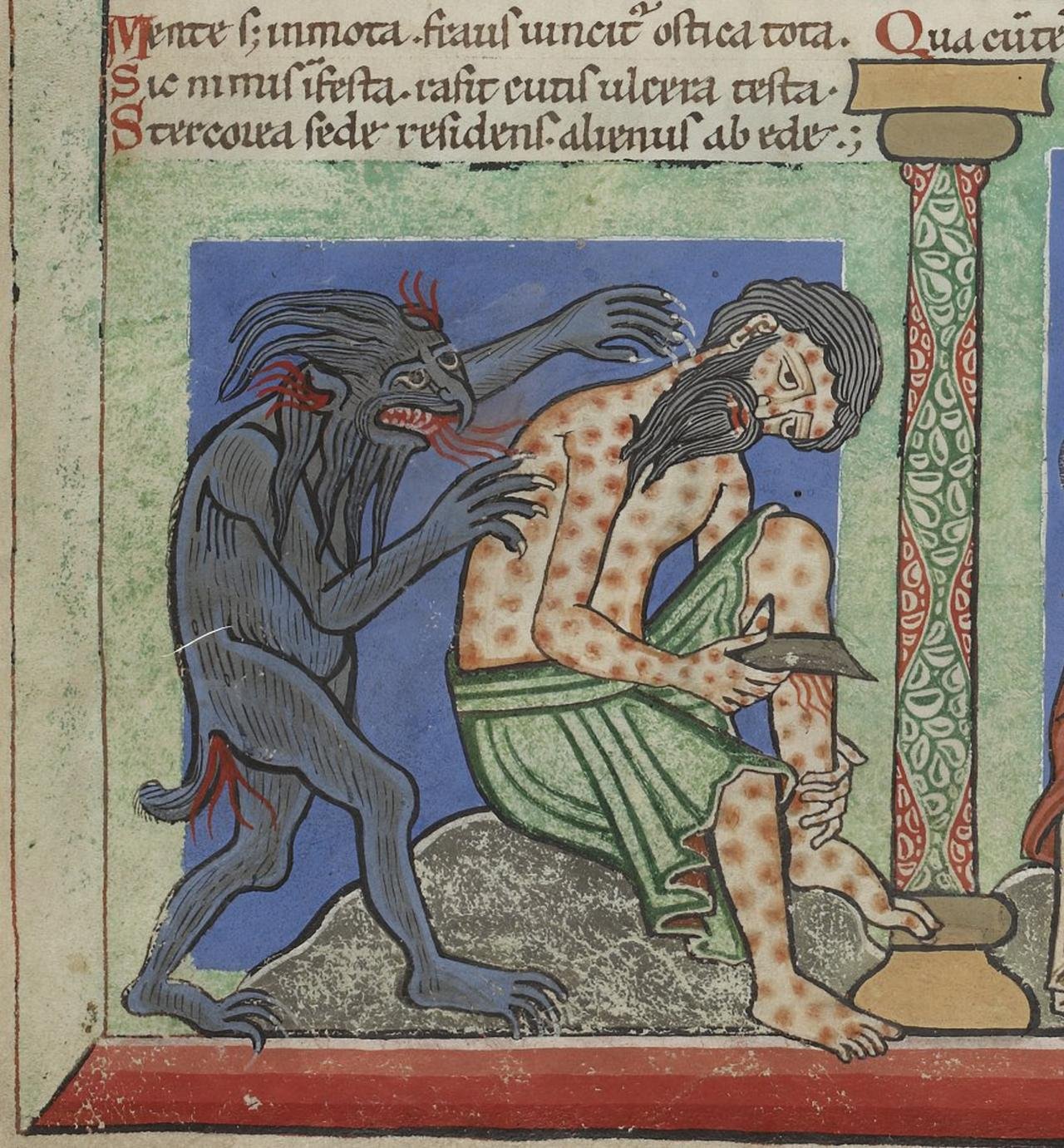 Leprosy existed in the Americas long before European contact, new study reveals