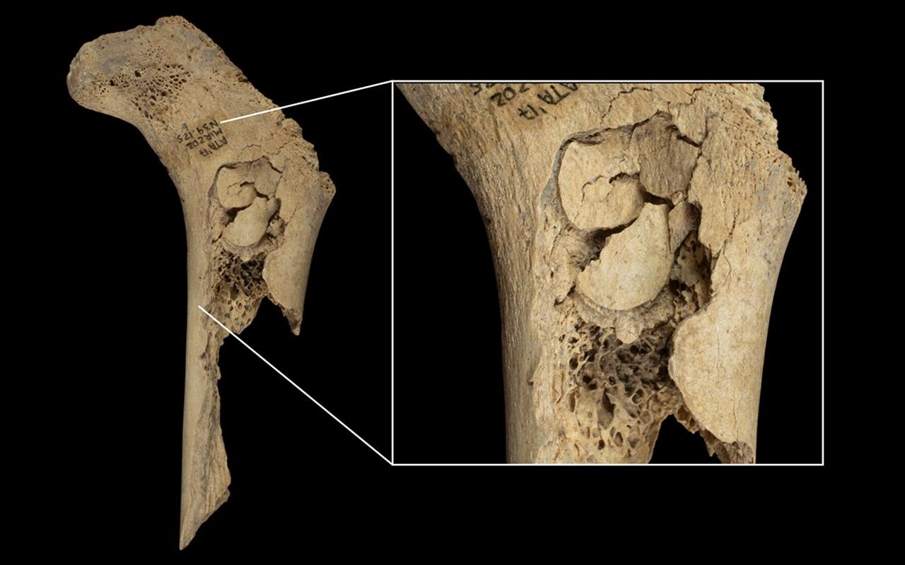 5,700-year-old cannibalism linked to Neolithic violence uncovered at El Mirador cave in Spain