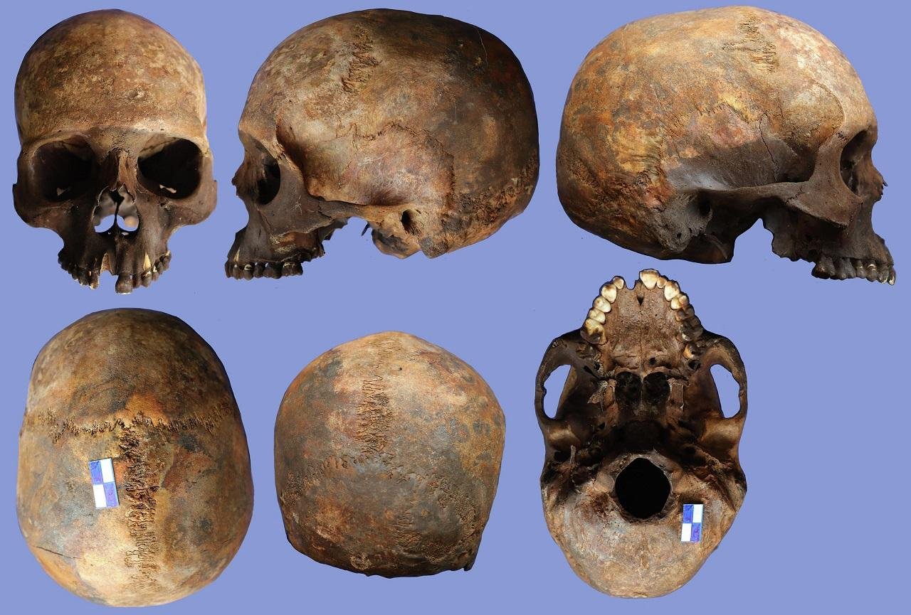 4th-century earthquake victims in Heraclea Sintica reveal care for disabled in Roman world